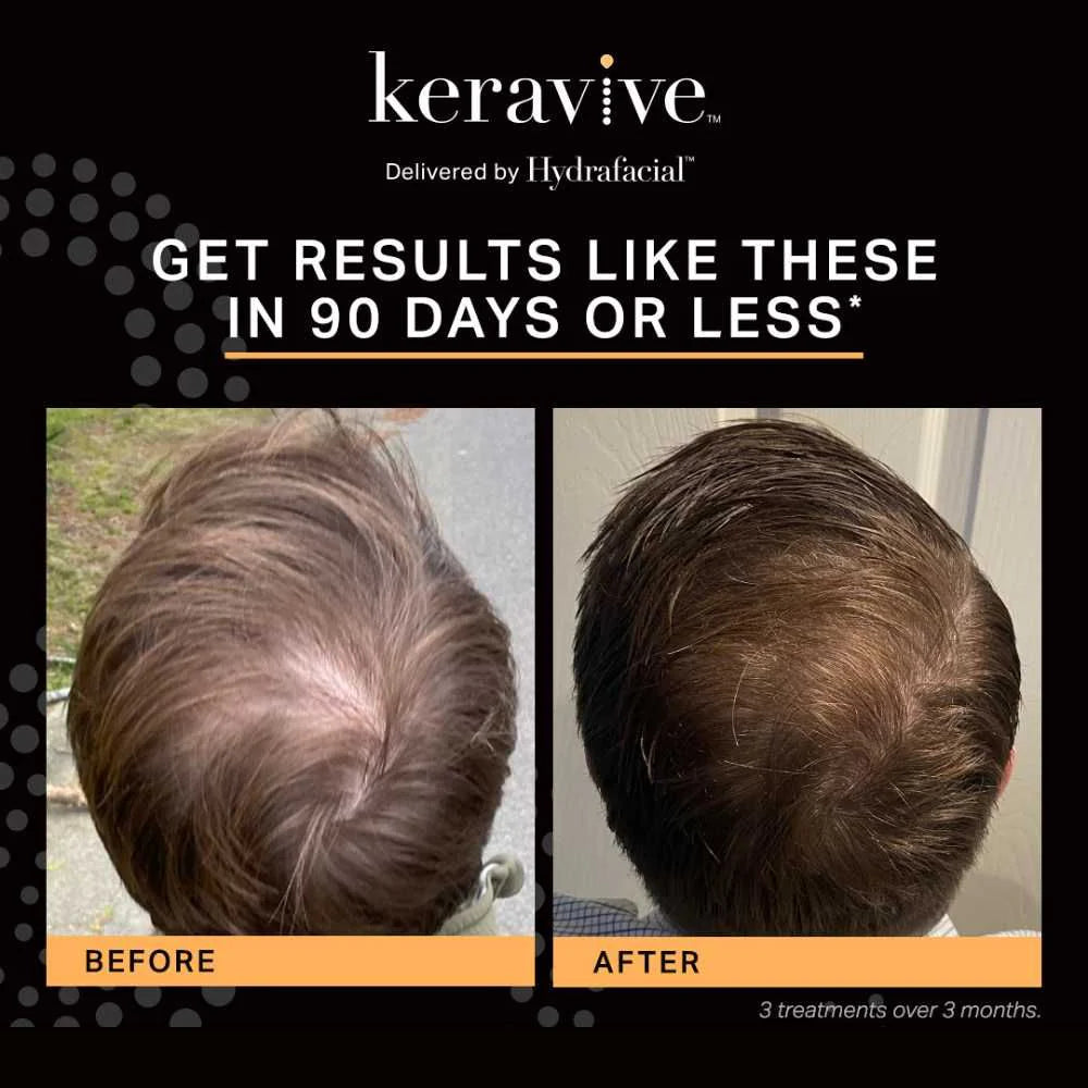 Keravive HydraScalp Complex Spray