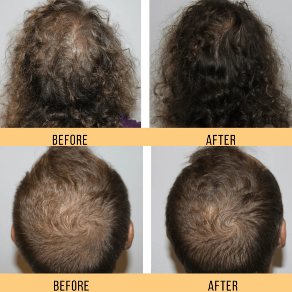 Keravive HydraScalp Complex Spray